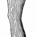 Lymphatics of the leg..jpg