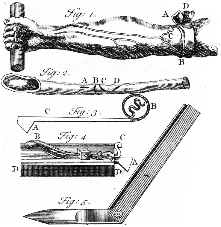 Instruments and technique of phlebotomy.jpg