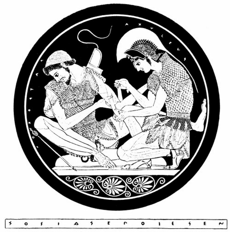 Achilles bandaging Patroclus,.jpg