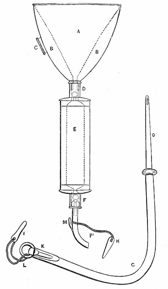 Mr. Higginson’s Transfusion Instrument.jpg