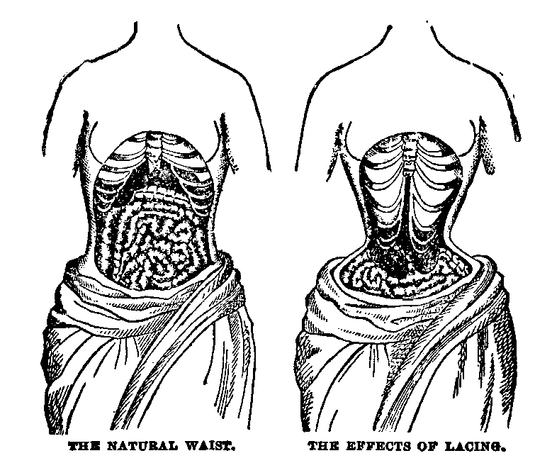 The Natural Waist and the Effects of Lacing.png